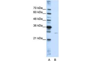 Western Blotting (WB) image for anti-EMG1 Nucleolar Protein Homolog (EMG1) antibody (ABIN2462205)