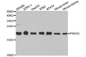 Western blot analysis of extracts of various cell lines, using PRDX2 antibody. (Peroxiredoxin 2 antibody  (AA 1-142))