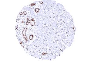 Intense nuclear TRPS1 staining of luminal but not basal breast epithelial cells Dilution 1:20 (Recombinant TRPS1 antibody  (AA 900-1100))