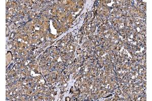 IHC analysis of MLX-interacting protein/MLXIP using anti-MLX-interacting protein/MLXIP antibody (ABIN7602593). (MLXIP antibody  (AA 88-348))