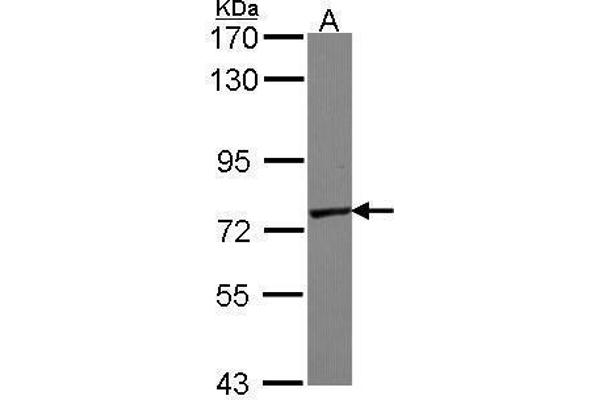 GALNT7 antibody  (Center)