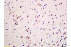 Formalin-fixed and paraffin embedded rat brain labeled with Anti-G protein beta subunit GI Polyclonal Antibody, Unconjugated (ABIN739094) at 1:200 followed by conjugation to the secondary antibody and DAB staining (GNB3 antibody  (AA 101-200))