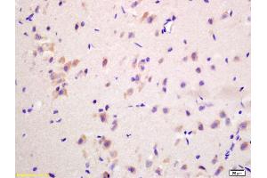 Formalin-fixed and paraffin embedded rat brain labeled with Anti-G protein beta subunit GI Polyclonal Antibody, Unconjugated (ABIN739094) at 1:200 followed by conjugation to the secondary antibody and DAB staining