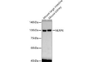 Western blot analysis of extracts of various cell lines, using NLRP6 antibody  at 1:1570 dilution. (NLRP6 antibody  (AA 100-200))