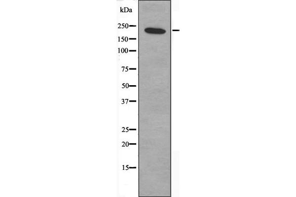 ZNF638 antibody  (Internal Region)