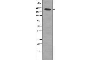 Western blot analysis of extracts from HepG2 cells, treated with serum (20%, 15mins), using ZNF638 antibody. (ZNF638 antibody  (Internal Region))