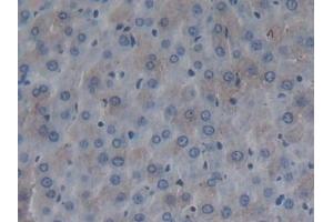 Detection of FMOD in Rat Liver Tissue using Polyclonal Antibody to Fibromodulin (FMOD) (Fibromodulin antibody  (AA 19-376))