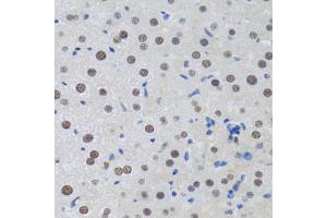 Immunohistochemistry of paraffin-embedded rat liver using MT antibody (ABIN6128251, ABIN6144117, ABIN6144118 and ABIN6222360) at dilution of 1:100 (40x lens). (MTA3 antibody  (AA 40-330))