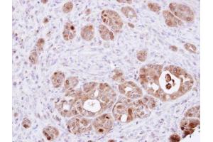 IHC-P Image Immunohistochemical analysis of paraffin-embedded NCIN87 xenograft, using DDT, antibody at 1:100 dilution. (DDT antibody)