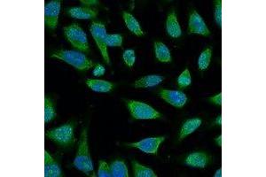 Immunofluorescent analysis of HSP70 staining in Hela cells.