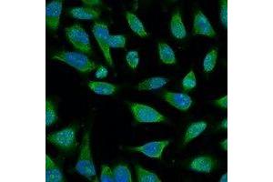 Immunofluorescent analysis of HSP70 staining in Hela cells. (HSP70 antibody)