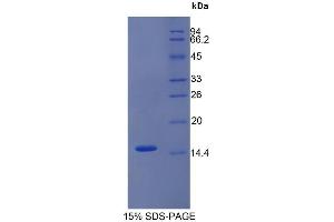 SDS-PAGE (SDS) image for Trefoil Factor 2 (TFF2) (AA 25-127) protein (His tag) (ABIN1525601)