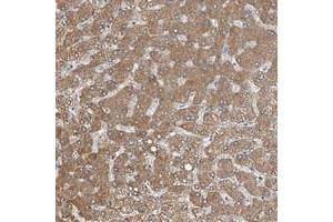 Immunohistochemical staining of human liver with MDGA1 polyclonal antibody  shows strong cytoplasmic positivity in hepatocytes at 1:20-1:50 dilution.