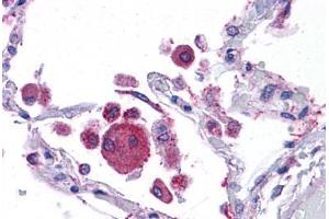 Human Lung: Formalin-Fixed, Paraffin-Embedded (FFPE) (KIT Ligand antibody  (AA 180-229))
