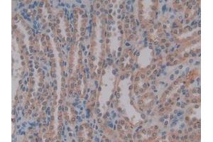 Immunohistochemistry (IHC) image for anti-Anti-Mullerian Hormone (AMH) (AA 447-553) antibody (ABIN7431407)