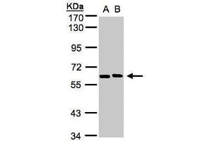 WB Image Sample(30 ug whole cell lysate) A:H1299 B:HeLa S3, 7. (NT5C2 antibody)