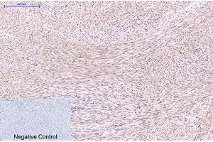 Immunohistochemical analysis of paraffin-embedded human uterus tissue. (EFHD1 antibody)