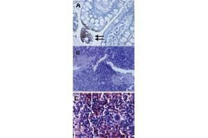 TLR3 Immunohistochemistry. (TLR3 antibody)