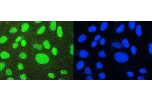IF analysis of PTBP1 using anti-PTBP1 antibody (ABIN7599451). (PTBP1 antibody  (AA 1-504))
