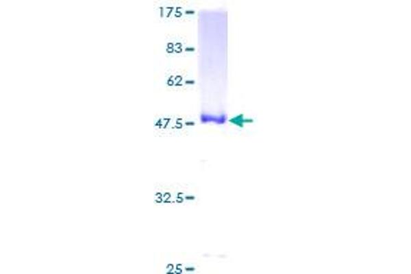 UBE2H Protein (AA 1-183) (GST tag)