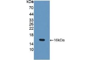 WB of Protein Standard: different control antibodies against Highly purified E. (Occludin ELISA Kit)