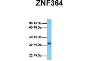 Host:  Rabbit  Target Name:  ZNF364  Sample Tissue:  Human 293T  Antibody Dilution:  1.