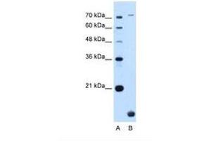 Image no. 1 for anti-Transmembrane Protein 91 (TMEM91) (N-Term) antibody (ABIN6739191) (TMEM91 antibody  (N-Term))