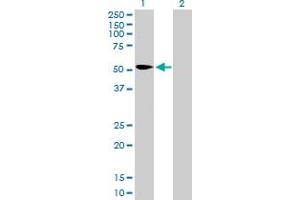 Western Blot analysis of KPNA2 expression in transfected 293T cell line by KPNA2 MaxPab polyclonal antibody. (KPNA2 antibody  (AA 1-529))