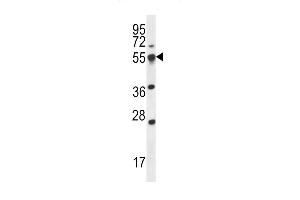 Western blot analysis in 293 cell line lysates (35ug/lane). (SMAP2 antibody  (AA 111-140))
