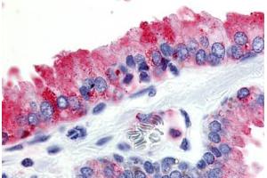 Human Prostate (formalin-fixed, paraffin-embedded) stained with GPR174 antibody ABIN213461 at 10 ug/ml followed by biotinylated goat anti-rabbit IgG secondary antibody ABIN481713, alkaline phosphatase-streptavidin and chromogen. (GPR174 antibody  (Cytoplasmic Domain))