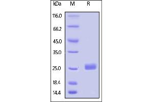 Biotinylated Human LAIR-2, His,Avitag on  under reducing (R) condition. (LAIR2 Protein (AA 22-152) (His tag,AVI tag,Biotin))