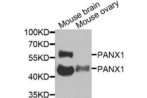 Western blot analysis of extracts of various cell lines, using PANX1 antibody (ABIN6290774) at 1:1000 dilution.