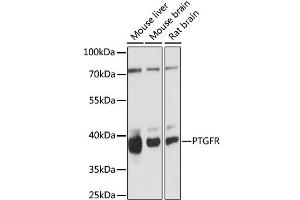 Western blot analysis of extracts of various cell lines, using PTGFR antibody (ABIN6293503) at 1:1000 dilution. (PTGFR antibody)