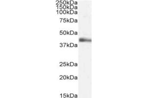 Western Blot using anti-Lymphotoxin alpha antibody 3F12. (Recombinant LTA antibody)