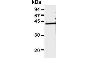 Western Blotting (WB) image for anti-Recombinase A / RecA (AA 260-347) antibody (ABIN1449298) (Recombinase A / RecA (AA 260-347) antibody)