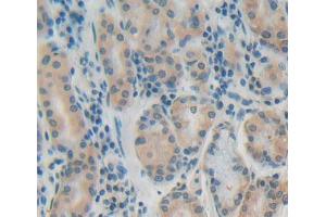 Used in DAB staining on fromalin fixed paraffin- embedded stomach tissue (PTP4A1 antibody  (AA 1-173))