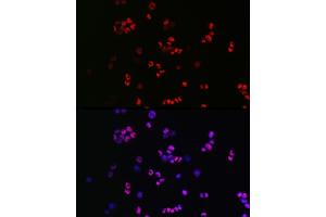 Immunofluorescence analysis of F9 cells using [KO Validated] SOX2 Rabbit pAb (ABIN3021002, ABIN3021003, ABIN3021004 and ABIN6213889) at dilution of 1:50 (40x lens). (SOX2 antibody  (AA 1-140))