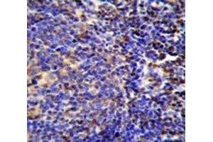S100A4 antibody immunohistochemistry analysis in formalin fixed and paraffin embedded human tonsil tissue. (s100a4 antibody  (AA 1-30))