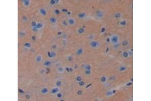 Figure. (TPT1 antibody  (AA 1-172))
