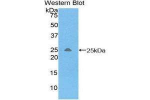 Western Blotting (WB) image for anti-Triggering Receptor Expressed On Myeloid Cells 1 (TREM1) (AA 21-205) antibody (ABIN1860864) (TREM1 antibody  (AA 21-205))