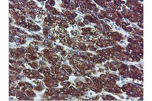 Image no. 11 for anti-IlvB (Bacterial Acetolactate Synthase)-Like (ILVBL) antibody (ABIN1498878)