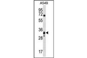 Western blot analysis of MCART6 Antibody (C-term) Cat. (MCART6 antibody  (C-Term))