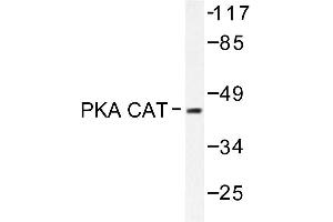 Image no. 1 for anti-V-Akt Murine Thymoma Viral Oncogene Homolog 1 (AKT1) antibody (ABIN272061) (AKT1 antibody)