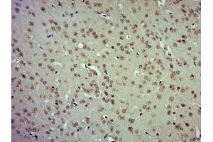 Paraformaldehyde-fixed, paraffin embedded mouse brain; Antigen retrieval by boiling in sodium citrate buffer (pH6. (ETV5 antibody  (AA 301-385))
