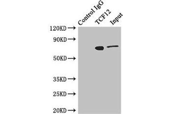 TCF12 抗体  (AA 443-682)