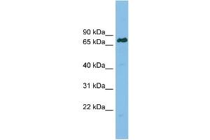 WB Suggested Anti-LBR Antibody Titration: 0.