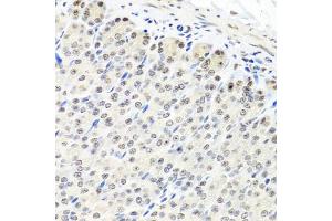 Immunohistochemistry of paraffin-embedded mouse stomach using CNOT8 antibody.