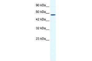 WB Suggested Anti-BTBD15 Antibody Titration:  0.