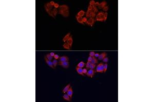 Immunofluorescence analysis of HeLa cells using MTOR antibody (ABIN2737201) at dilution of 1:100. (MTOR antibody)