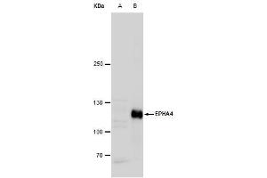WB Image Eph receptor A4 antibody [N3C2], Internal detects Eph receptor A4 protein by western blot analysis. (EPH Receptor A4 antibody)